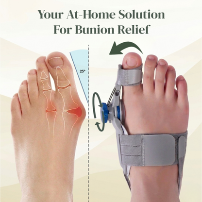 Straighten Your Bunion At Home - Visible Relief in as Little as 30 Days